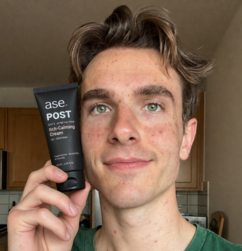 Ollie holding his ASE skincare tube
