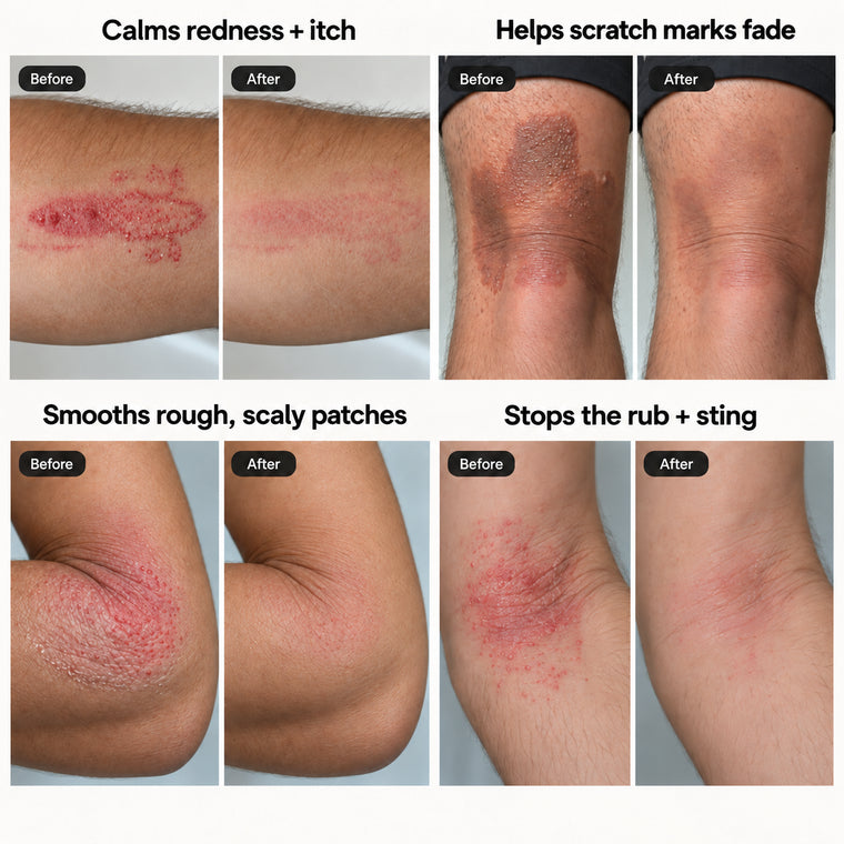 Before and after of rough, irritated skin turning smooth.